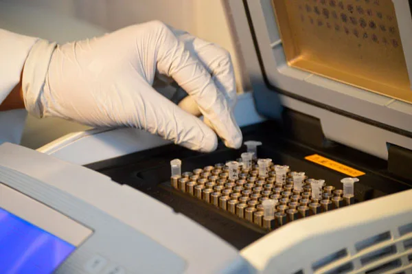 Ecuador cuenta con una red solvente para diagnóstico de FOC R4T