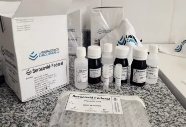 Argentina desarrolla kit que detecta anticuerpos contra COVID-19 en animales