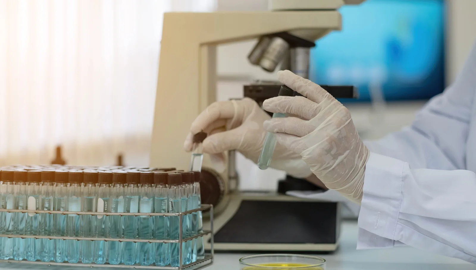 Internacional: Una terapia derivada de una proteína de la banana podría funcionar contra el SARS-CoV-2